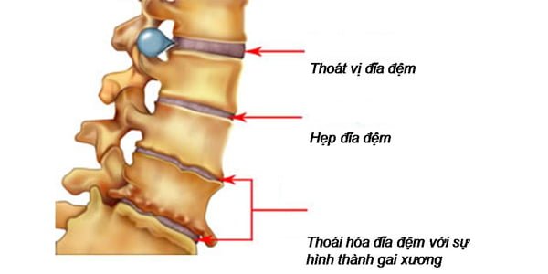 Ai là người sáng chế ra phương pháp châm dao siêu vi?
